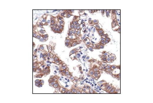 Immunohistochemistry Image 2: Pan-Cadherin Antibody