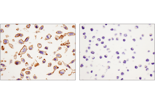 Immunohistochemistry Image 3: Catenin δ-1 (D7S2M) XP<sup>®</sup> Rabbit mAb