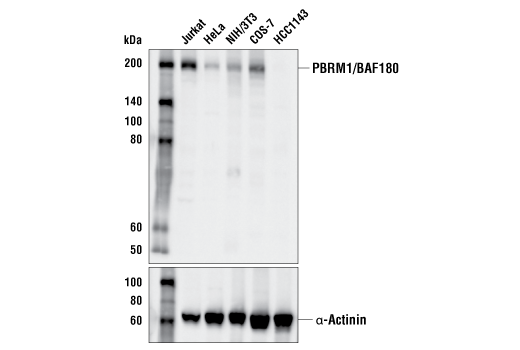 undefined Image 7: BAF Complex IHC Antibody Sampler Kit