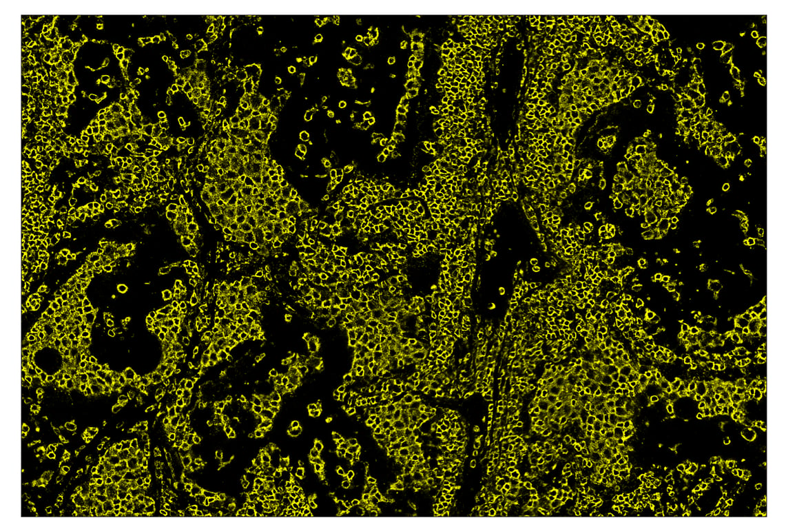 Immunohistochemistry Image 3: CD45 (Intracellular Domain) (D9M8I) & CO-0013-750 SignalStar<sup>™</sup> Oligo-Antibody Pair