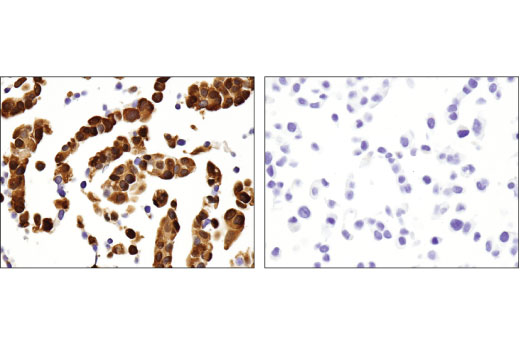 Immunohistochemistry Image 3: ALDH1A1 (D9Q8E) XP<sup>®</sup> Rabbit mAb (BSA and Azide Free)