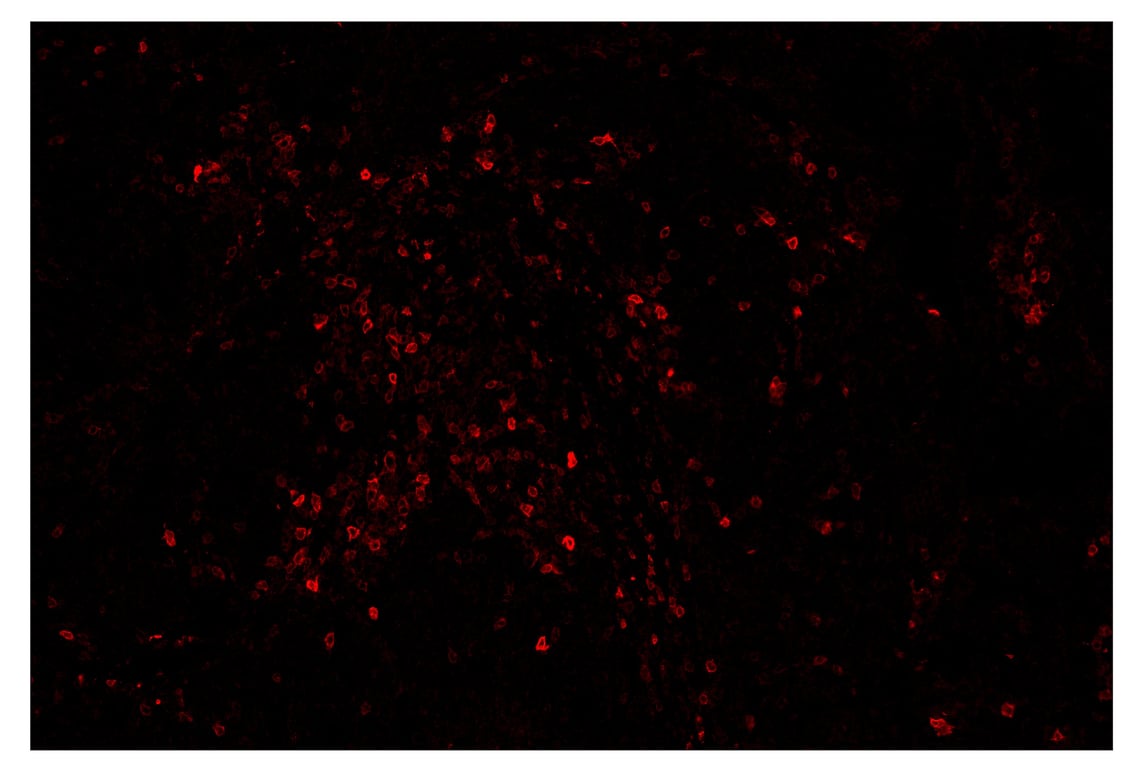 Immunohistochemistry Image 4: ICOS (D1K2T<sup>™</sup>) & CO-0027-594 SignalStar<sup>™</sup> Oligo-Antibody Pair