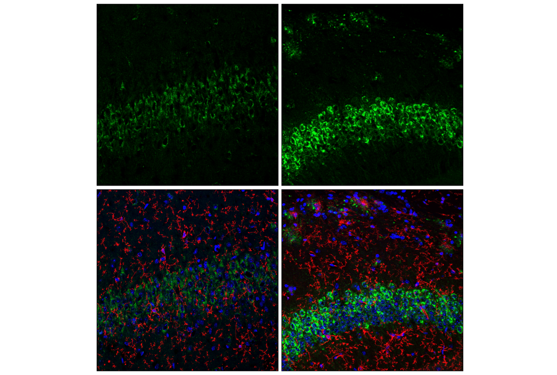 Immunofluorescence Image 1: APP (E4H1U) Rabbit mAb