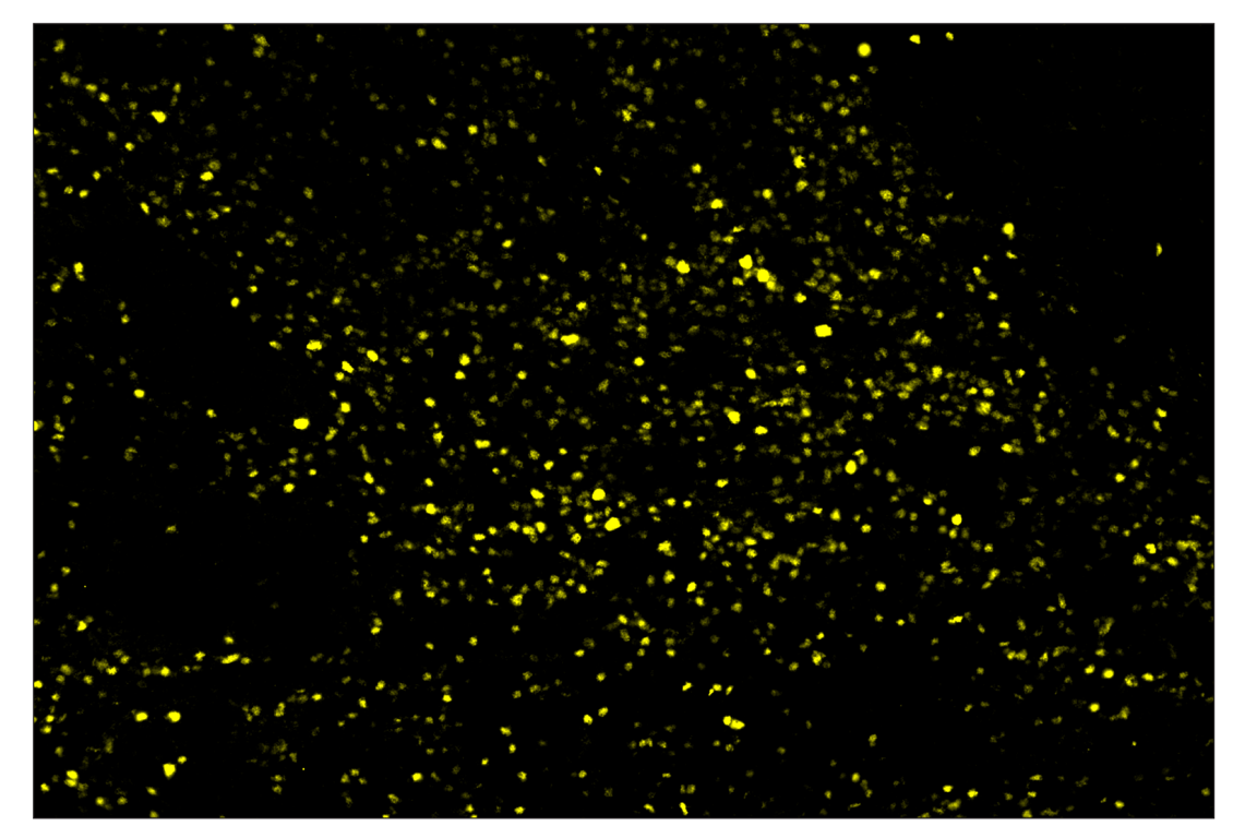 Immunohistochemistry Image 2: T-bet/TBX21 (E4I2K) & CO-0077-647 SignalStar<sup>™</sup> Oligo-Antibody Pair