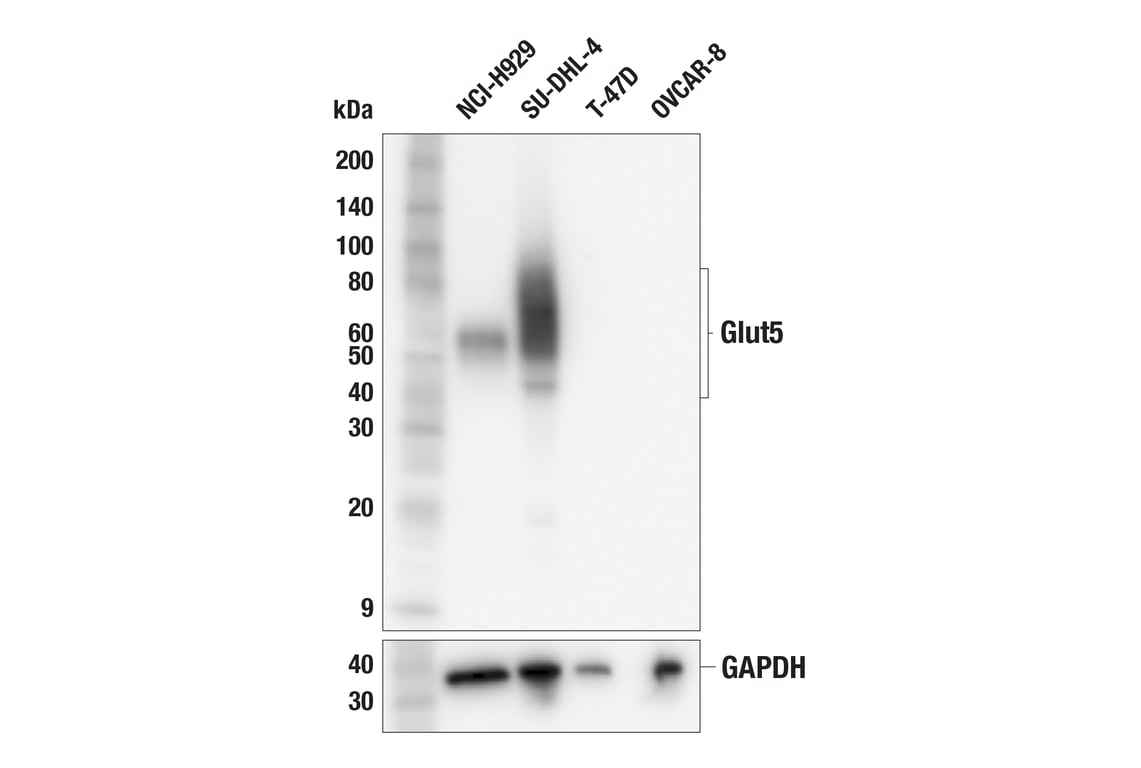 Western Blotting Image 1: Glut5 (F4A5K) Rabbit mAb