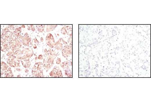 Immunohistochemistry Image 1: Akt (pan) (11E7) Rabbit mAb