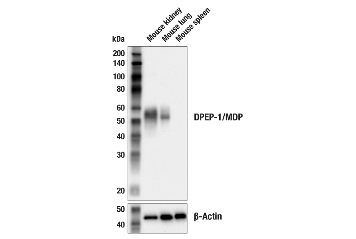 Western Blotting Image 2: DPEP-1/MDP (E5H7T) Rabbit mAb