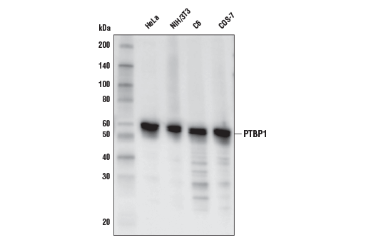 Western Blotting Image 1: PTBP1 (E4I3Q) Rabbit mAb