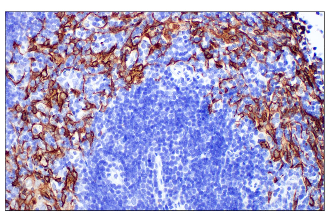 Immunohistochemistry Image 8: Keratin 14 (E7W6V) Rabbit mAb