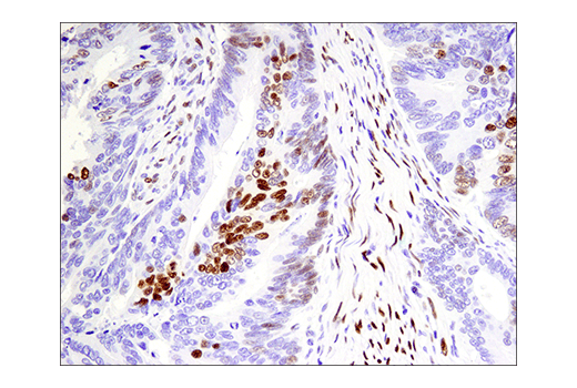 Immunohistochemistry Image 3: Phospho-ATF-2 (Thr71)/ATF-7 (Thr53) (E4A5G) XP<sup>®</sup> Rabbit mAb