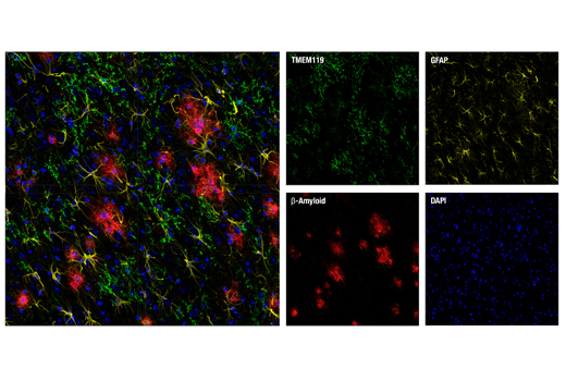 Immunofluorescence Image 2: TMEM119 (E3E1O) Rabbit mAb