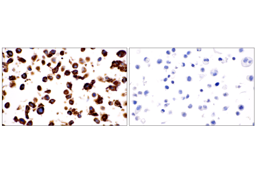 Immunohistochemistry Image 9: COL1A1 (E8F4L) XP<sup>®</sup> Rabbit mAb (BSA and Azide Free)