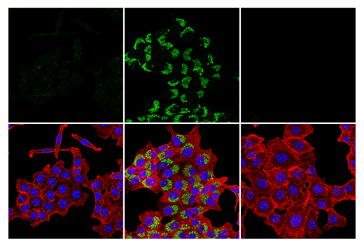 Immunofluorescence Image 1: LC3B (D11) XP<sup>®</sup> Rabbit mAb (BSA and Azide Free)