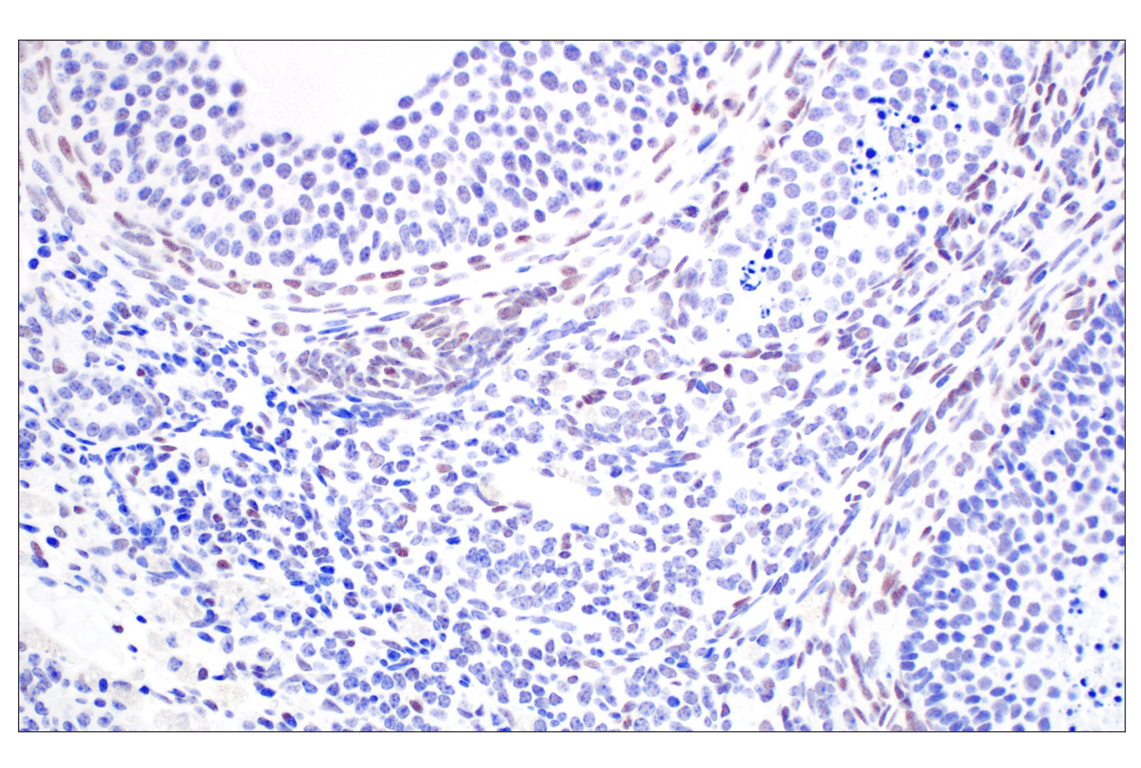 Immunohistochemistry Image 7: TCF4/ITF2 (E3X2Y) Rabbit mAb