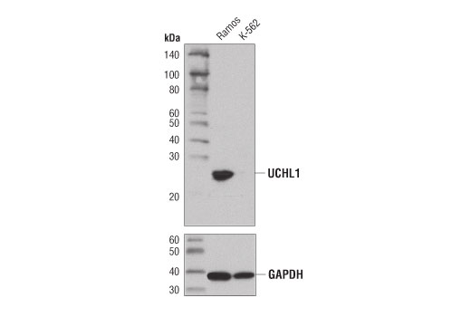 Western Blotting Image 3: UCHL1 (D3T2E) XP<sup>®</sup> Rabbit mAb