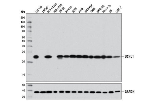 Western Blotting Image 2: UCHL1 (D3T2E) XP<sup>®</sup> Rabbit mAb (Biotinylated)