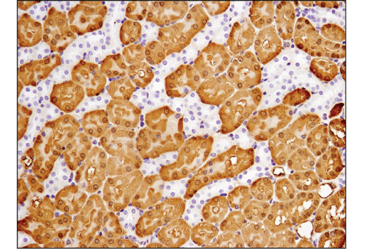 Immunohistochemistry Image 2: ASS1 (D4O4B) XP<sup>®</sup> Rabbit mAb