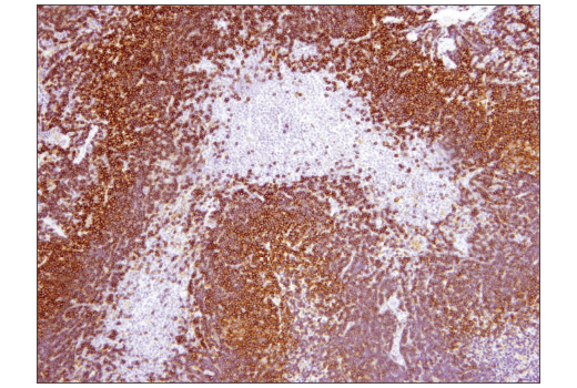 Immunohistochemistry Image 5: CD19 (Intracellular Domain) (D4V4B) XP<sup>®</sup> Rabbit mAb