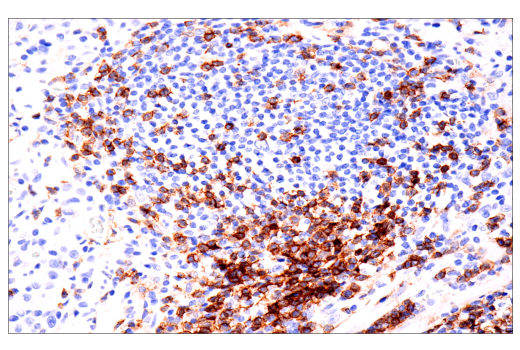 Immunohistochemistry Image 6: CD4 (EP204) Rabbit mAb