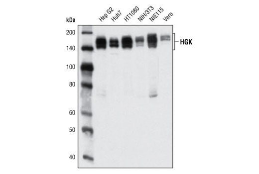 Western Blotting Image 1: HGK (D19H10) Rabbit mAb