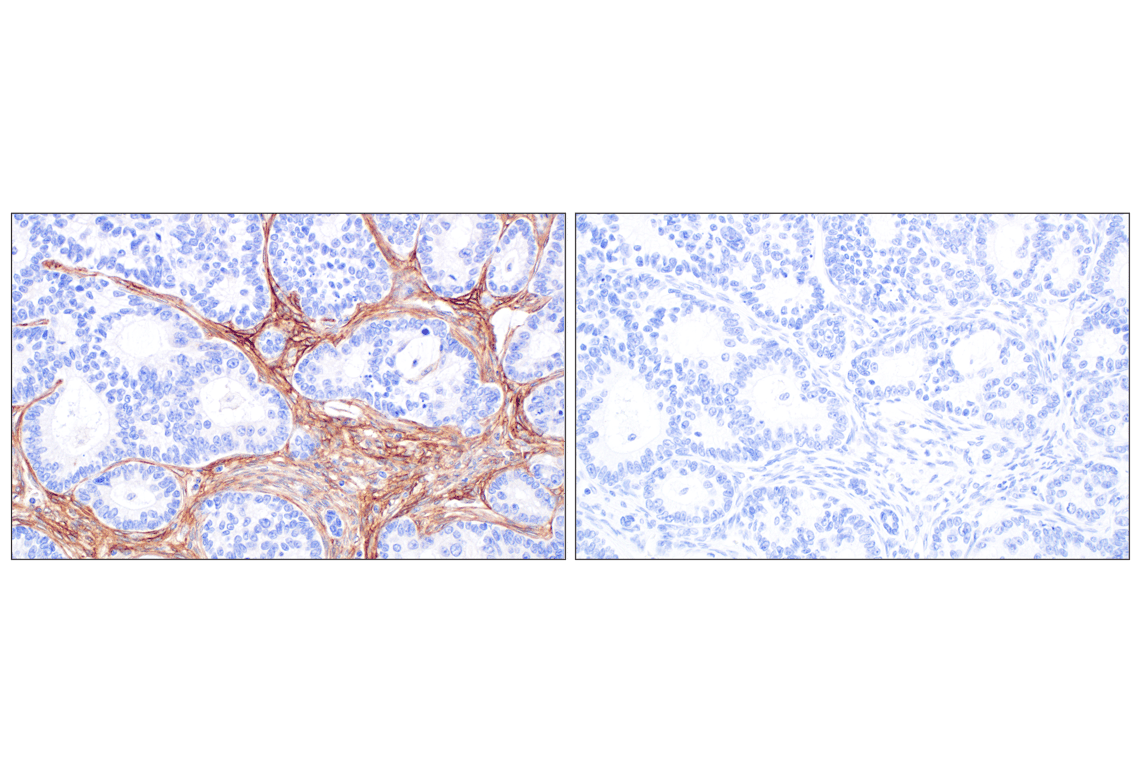 Immunohistochemistry Image 8: CD105/Endoglin (F9C5Q) Rabbit mAb