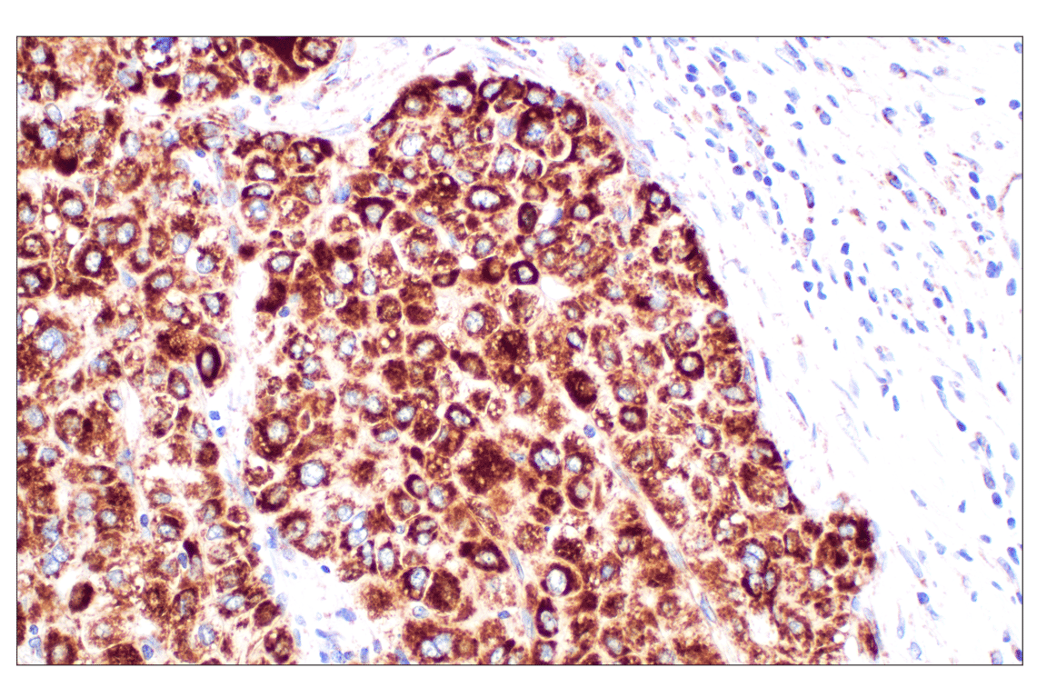 undefined Image 22: Cell Fractionation Antibody Sampler Kit