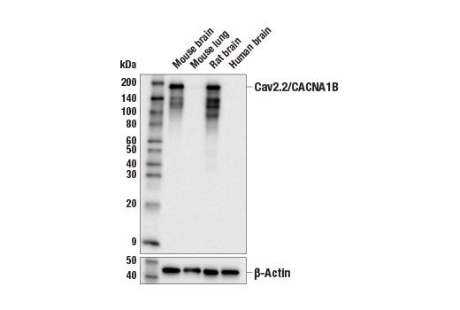 Western Blotting Image 1: Cav2.2/CACNA1B (E2Q1Y) Rabbit mAb