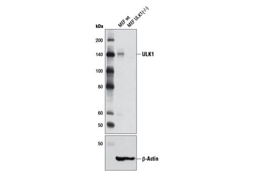 undefined Image 6: PhosphoPlus<sup>®</sup> ULK1 (Ser555) Antibody Duet