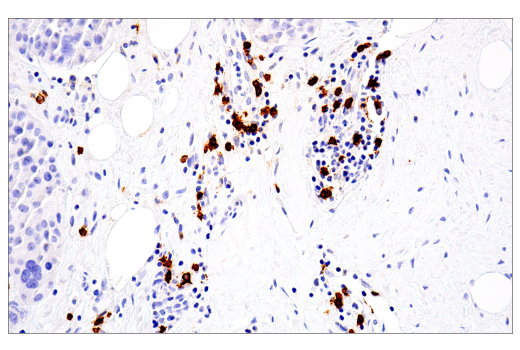 Immunohistochemistry Image 1: CD20 (L26) Mouse mAb