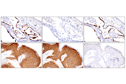 Immunohistochemistry Image 5: Pan-Keratin (5D3/LP34) Mouse mAb