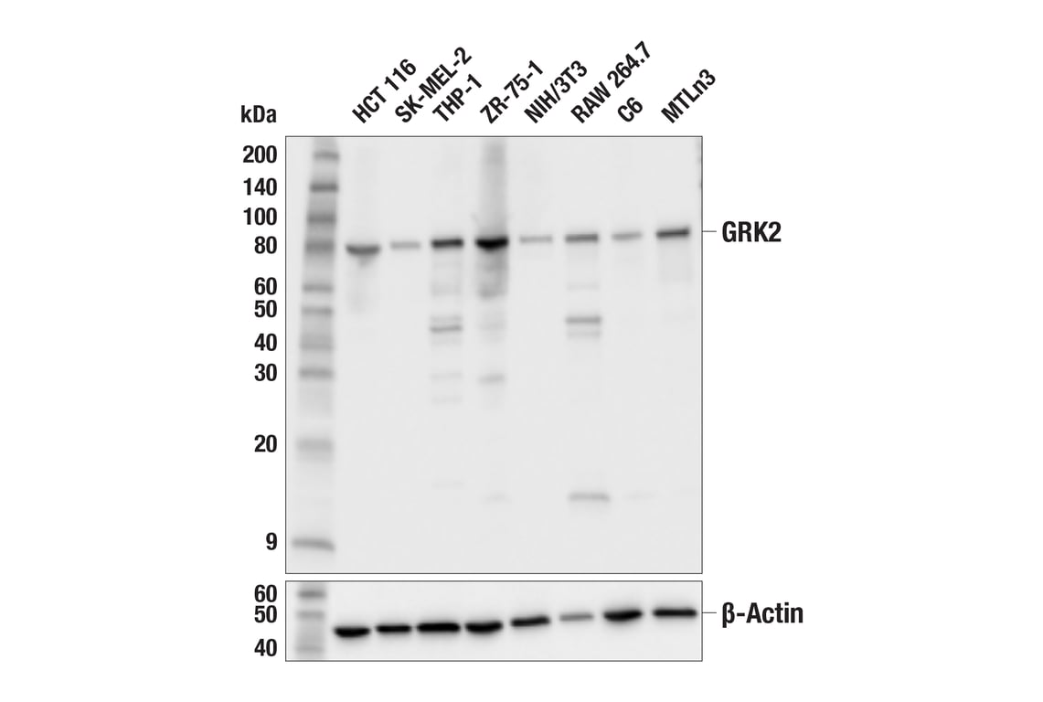 Western Blotting Image 2: GRK2 (E8A7E) Rabbit mAb