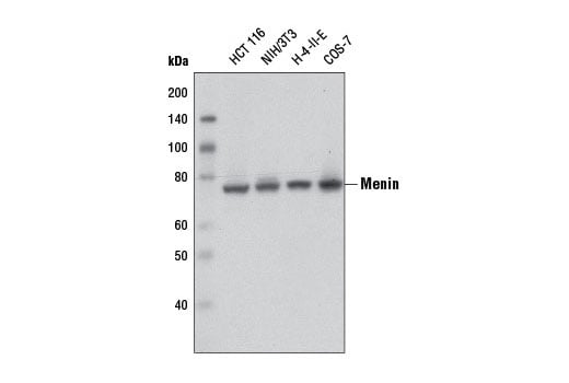 Western Blotting Image 1: Menin (D45B1) XP<sup>®</sup> Rabbit mAb