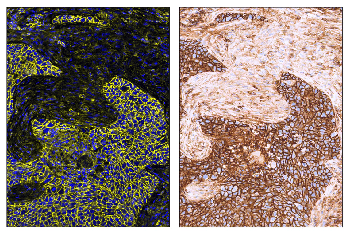 Immunohistochemistry Image 6: CD44 (E7K2Y) & CO-0030-750 SignalStar<sup>™</sup> Oligo-Antibody Pair