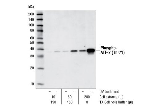 Immunoprecipitation Image 1: Phospho-p38 MAPK (Thr180/Tyr182) (28B10) Mouse mAb (Sepharose® Bead Conjugate)
