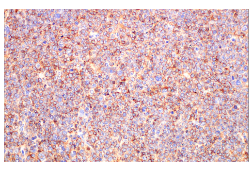 Immunohistochemistry Image 1: CD20 (E3N7O) XP<sup>®</sup> Rabbit mAb (BSA and Azide Free)