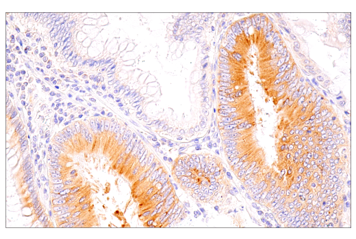 Immunohistochemistry Image 4: G3BP1 (E9G1M) XP<sup>®</sup> Rabbit mAb