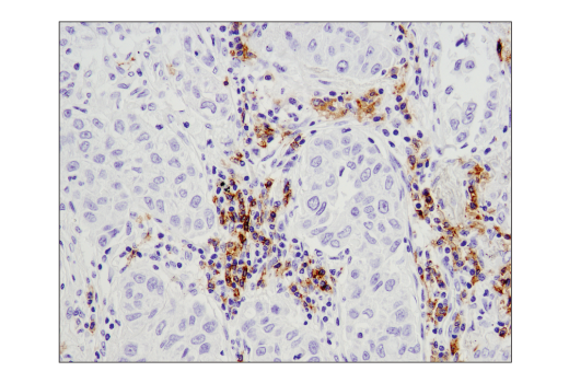 Immunohistochemistry Image 2: CD19 (Intracellular Domain) (D4V4B) XP<sup>®</sup> Rabbit mAb (BSA and Azide Free)