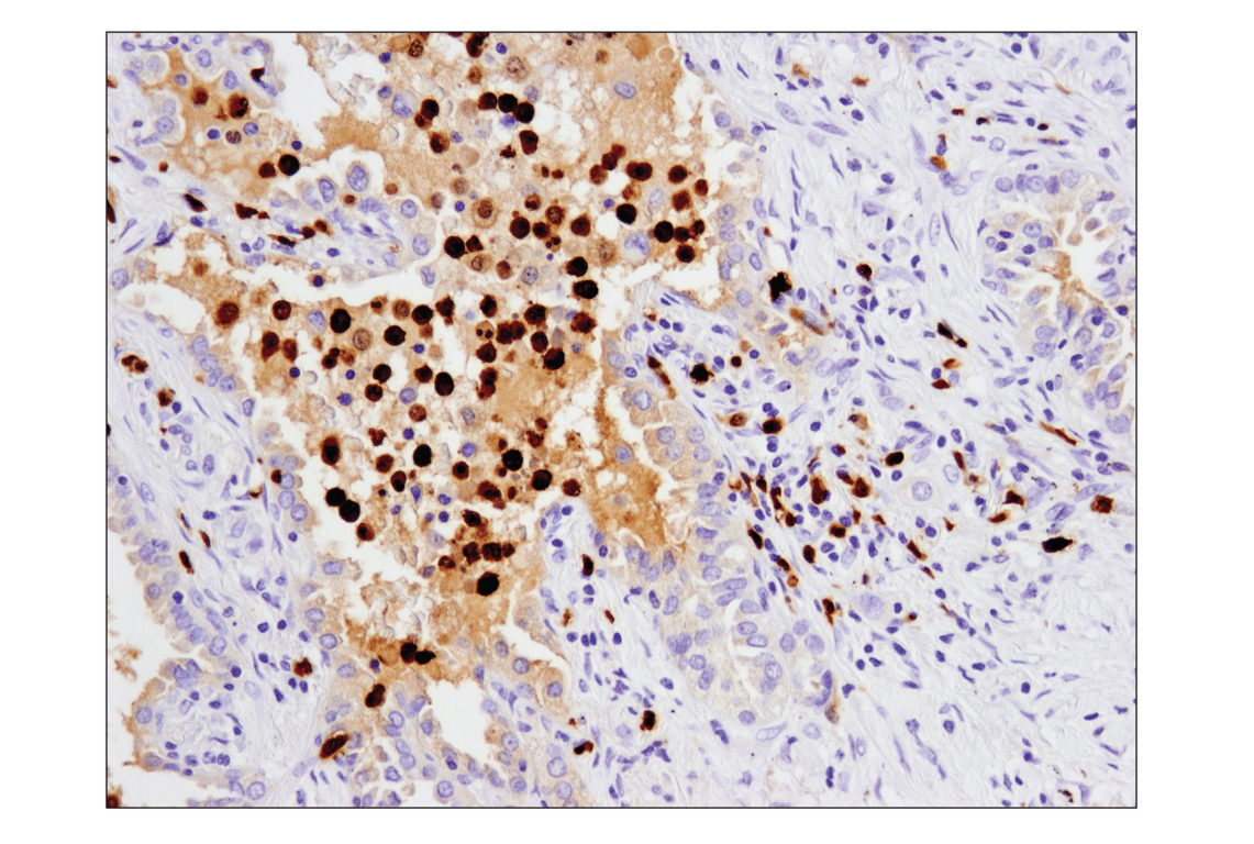 Immunohistochemistry Image 2: S100A9 (D5O6O) Rabbit mAb (BSA and Azide Free)