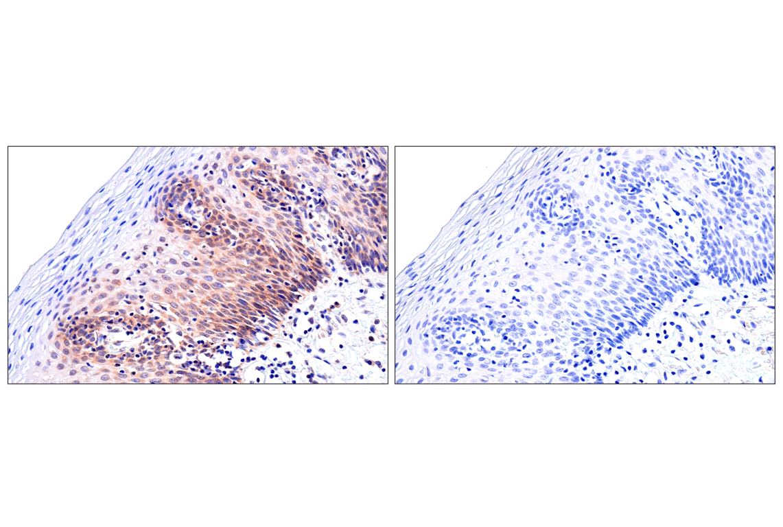 Immunohistochemistry Image 12: ADAR1 p150 Isoform (E6U1U) Rabbit mAb