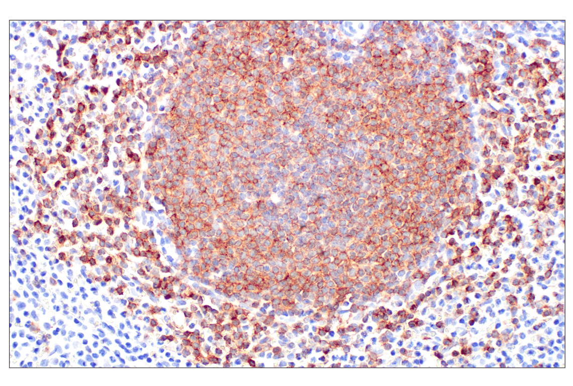undefined Image 47: B Cell Signaling Antibody Sampler Kit II