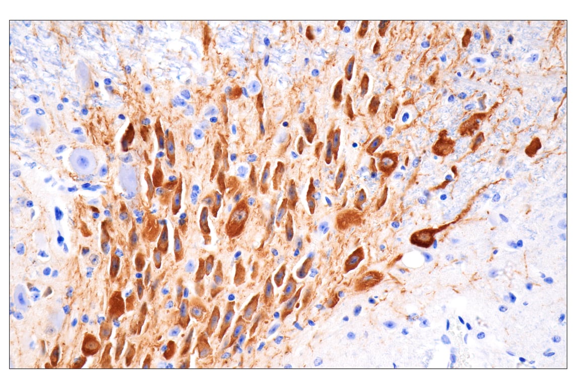 Immunohistochemistry Image 1: Tyrosine Hydroxylase (E2L6M) Rabbit mAb (BSA and Azide Free)