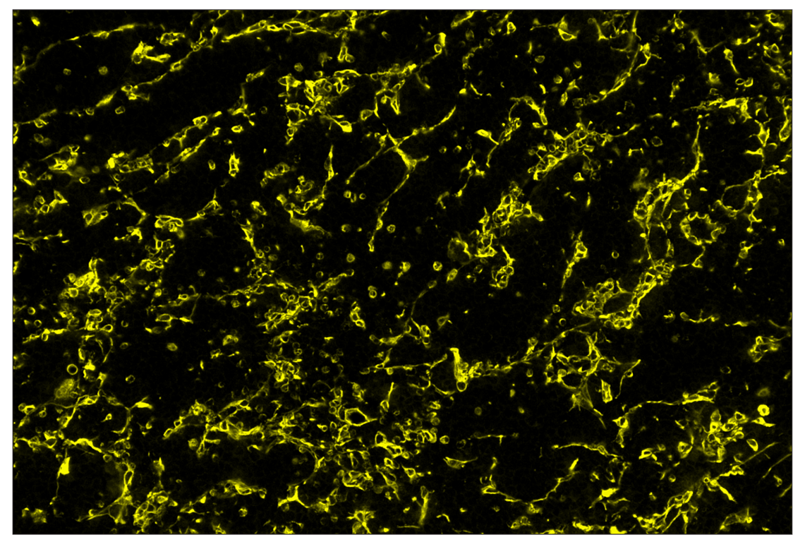 Immunohistochemistry Image 3: CD206/MRC1 (E6T5J) & CO-0032-647 SignalStar<sup>™</sup> Oligo-Antibody Pair