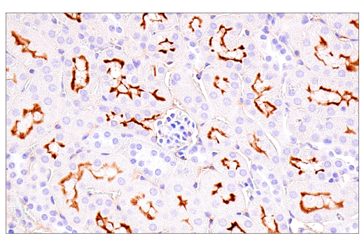 undefined Image 38: SARS-CoV-2 Virus-Host Interaction Antibody Sampler Kit
