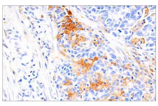 Immunohistochemistry Image 3: GM-CSF Receptor α (E8Z3S) Rabbit mAb