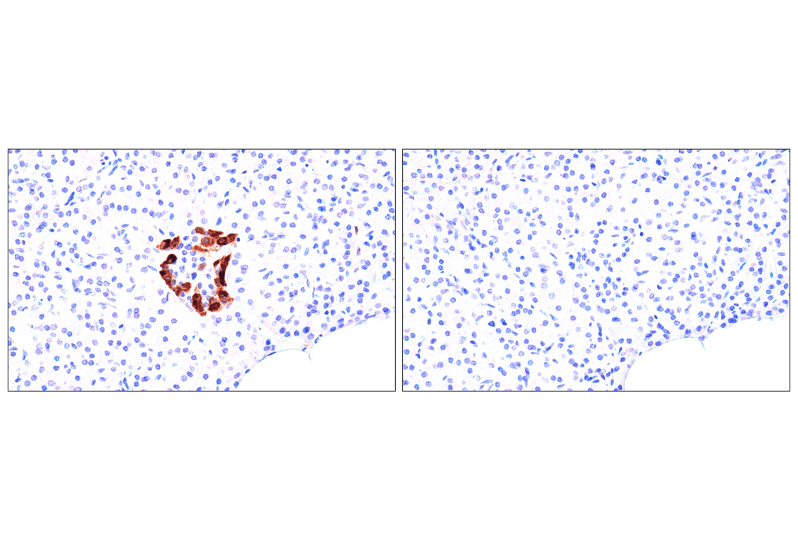 Immunohistochemistry Image 14: FAP (F1A4G) Rabbit mAb (BSA and Azide Free)