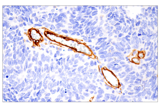 Immunohistochemistry Image 4: Integrin α1/CD49a (E9K2J) XP<sup>®</sup> Rabbit mAb (BSA and Azide Free)