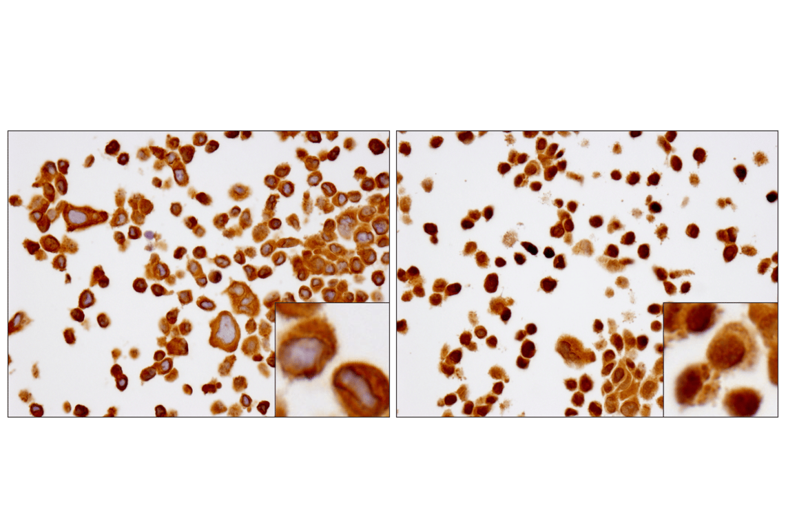 undefined Image 14: PhosphoPlus<sup>®</sup> NF-κB p65/RelA (Ser536) Antibody Duet
