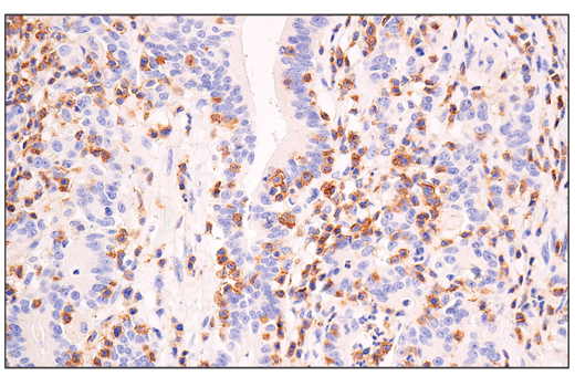 Immunohistochemistry Image 2: Semaphorin-4D/CD100 (E5C3B) XP<sup>®</sup> Rabbit mAb