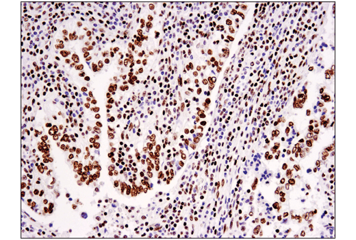 Immunohistochemistry Image 1: Tri-Methyl-Histone H3 (Lys36) (D5A7) XP<sup>®</sup> Rabbit mAb