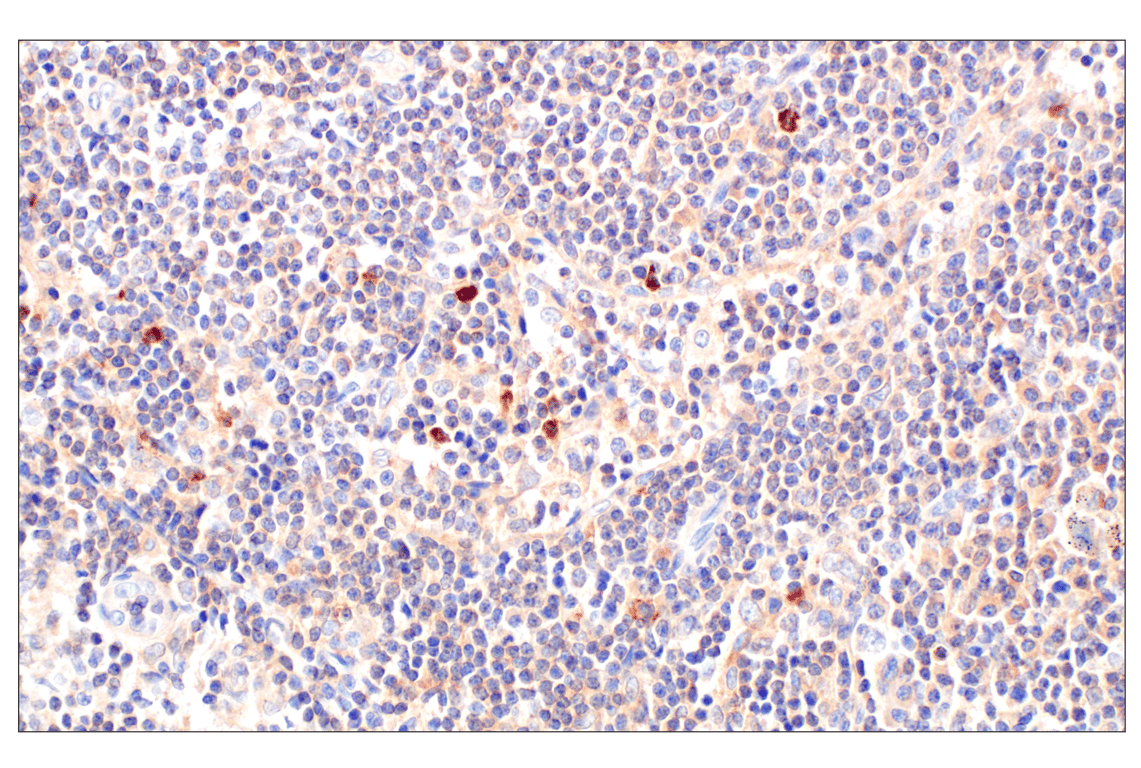 undefined Image 17: Rho-GTPase Antibody Sampler Kit